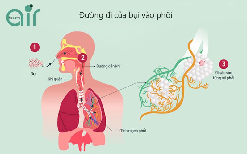 Ảnh hưởng của bụi đối với Phổi gây ra những điều gì?